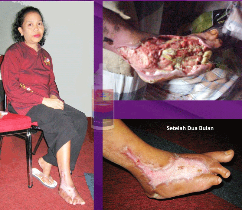 Testimoni 2