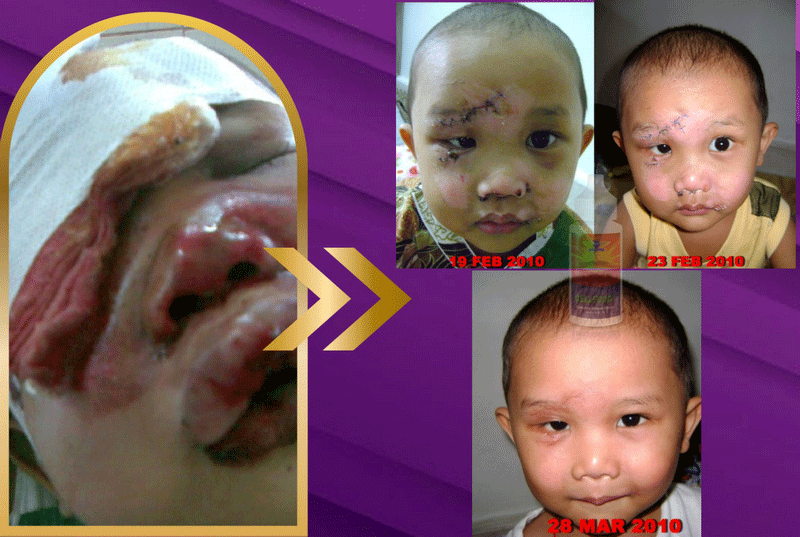 Testimoni 5
