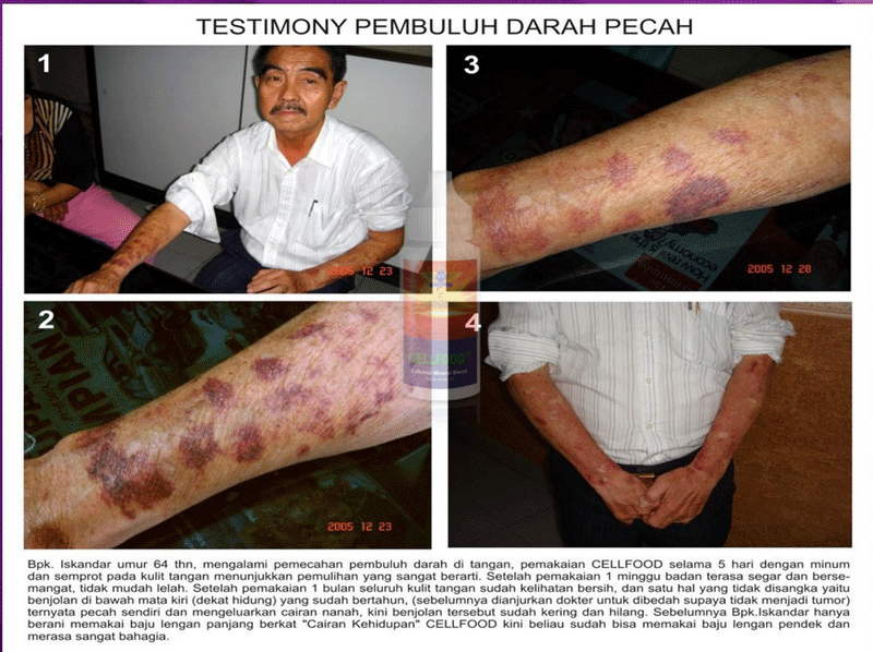 Testimoni 11