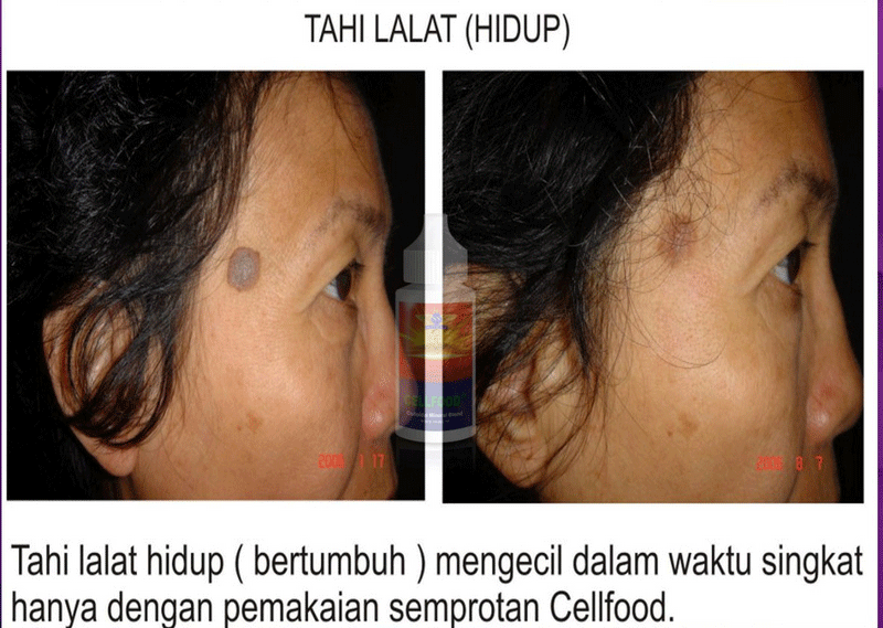 Testimoni 14